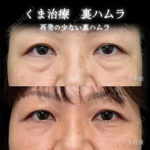 eクリニック 大阪院 脇谷 雄一朗医師の症例