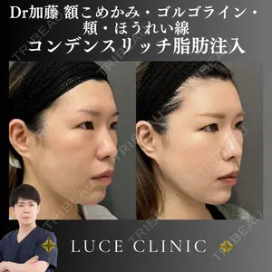 ルーチェクリニック 銀座院 加藤晴之輔医師の症例
