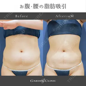 ガーデンクリニック 池袋院の症例