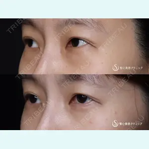 聖心美容クリニック 大阪院 寺町 英明医師の症例