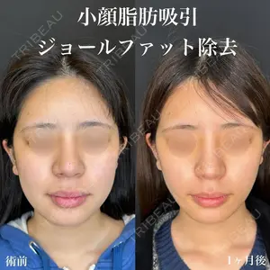 ルラ美容クリニック 名古屋栄院 関戸 優医師の症例