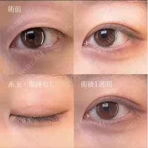 症例