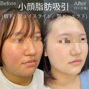 ルラ美容クリニック 渋谷本院の症例