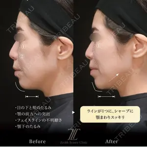 Zetith Beauty Clinic 福岡院 温 恵理医師の症例