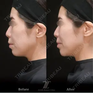 Zetith Beauty Clinic 福岡院 温 恵理医師の症例
