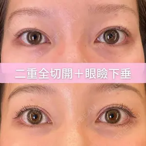 症例