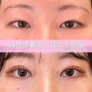症例