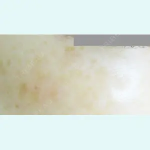 城本クリニック 立川院の症例