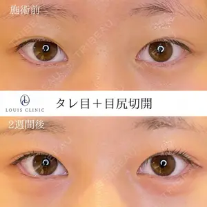 LOUIS CLINIC 二子玉川院【ルイクリニック】 小松 塁医師の症例