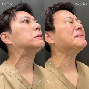 NEXUS CLINICの症例