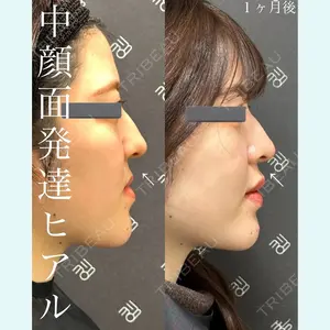 症例