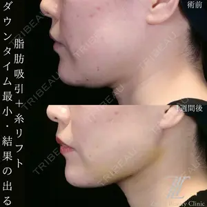 Zetith Beauty Clinic 大阪心斎橋院 井上 史洋医師の症例