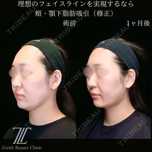 Zetith Beauty Clinic 大阪心斎橋院 井上 史洋医師の症例
