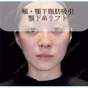 Zetith Beauty Clinic 大阪心斎橋院 井上 史洋医師の症例