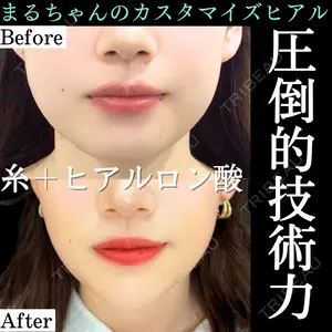 症例