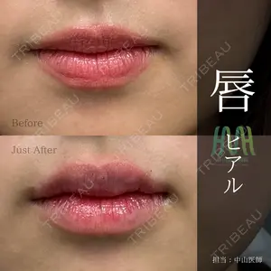春山記念病院 中山医師の症例