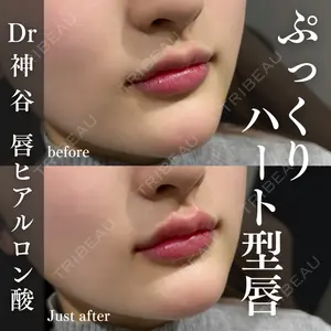 EMMO FACE CLINIC 大阪梅田院 神谷 一成医師の症例