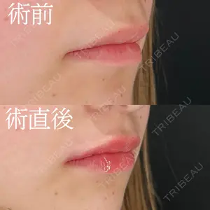 HAAB×DREAM BEAUTY CLINIC 大阪梅田院 柏木 太雅医師の症例