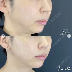 湘南美容クリニック 西葛西院の症例