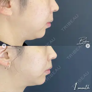 湘南美容クリニック 西葛西院の症例