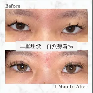 KIMI CLINIC 形成・美容外科 志藤 宏計医師の症例
