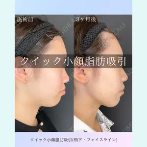 ルラ美容クリニック 札幌院 佐藤 雄紀医師の症例