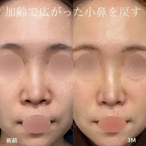 グローバルビューティークリニック 大阪院 大阪院院長 羽根和秀医師の症例