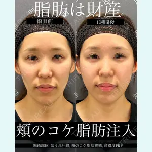 症例