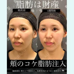 症例