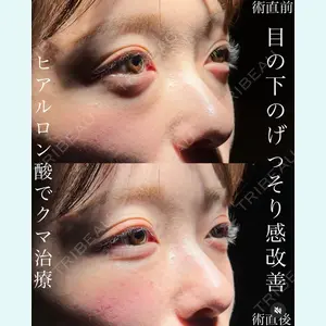 症例