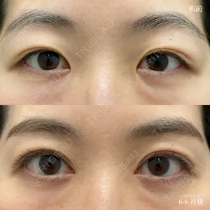 湘南美容クリニック 銀座院の症例