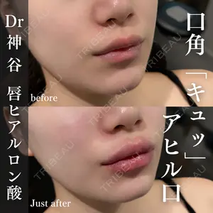 EMMO FACE CLINIC 大阪梅田院 神谷 一成医師の症例