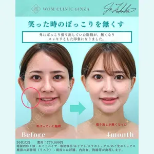 WOM CLINIC GINZA （ワム クリニック ギンザ） 深堀 純也医師の症例