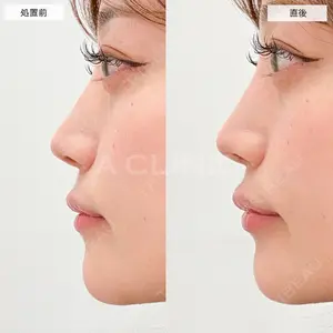 A CLINIC（エークリニック） 大阪院 田窪 賢志郎医師の症例