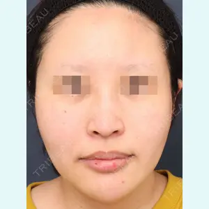 プリモ麻布十番クリニック 高橋 範夫医師の症例
