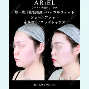 アリエル美容クリニック 大宮院 鈴木　桂介医師の症例