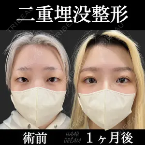 症例