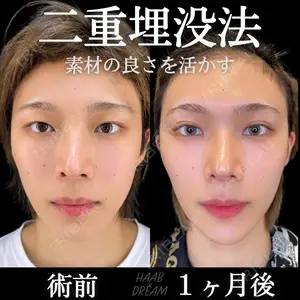 症例