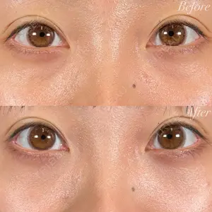 R Beauty CLINIC 名古屋院 木村 尚大医師の症例