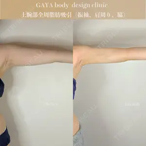 GAYA body design clinic 飯ヶ谷 重来医師の症例