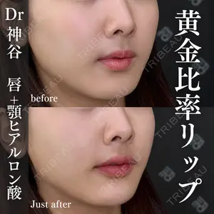 EMMO FACE CLINIC 大阪梅田院 神谷 一成医師の症例