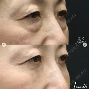 湘南美容クリニック 二子玉川院 青柳 萌花医師の症例