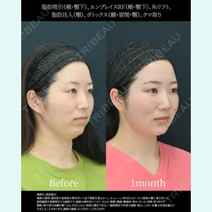 湘南美容クリニック 名古屋院 山本 高士医師の症例