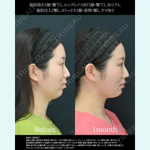 湘南美容クリニック 名古屋院 山本 高士医師の症例