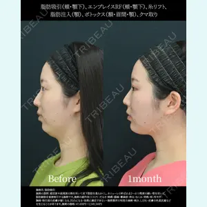 湘南美容クリニック 名古屋院 山本 高士医師の症例