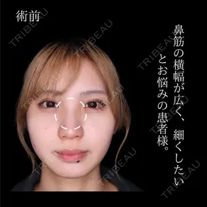 吉祥寺アイビークリニック 升本　浩紀医師の症例