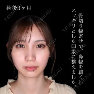 吉祥寺アイビークリニック 升本　浩紀医師の症例