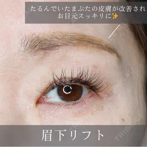 吉祥寺アイビークリニック 升本　浩紀医師の症例