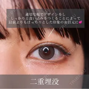 吉祥寺アイビークリニック 升本　浩紀医師の症例