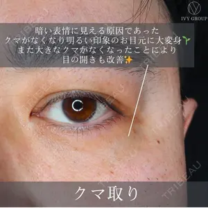 吉祥寺アイビークリニック 升本　浩紀医師の症例